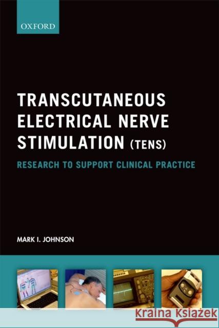 Transcutaneous Electrical Nerve Stimulation (TENS): Research to Support Clinical Practice Johnson, Mark I. 9780199673278 Oxford University Press, USA