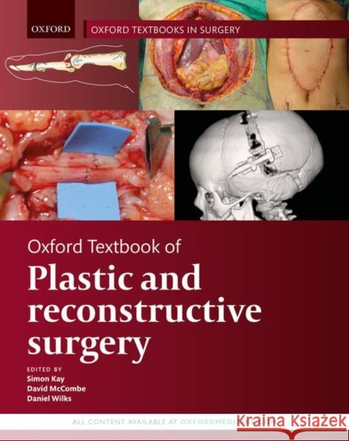 Oxford Textbook of Plastic and Reconstructive Surgery Simon Kay Daniel Wilks David McCombe 9780199682874 Oxford University Press, USA