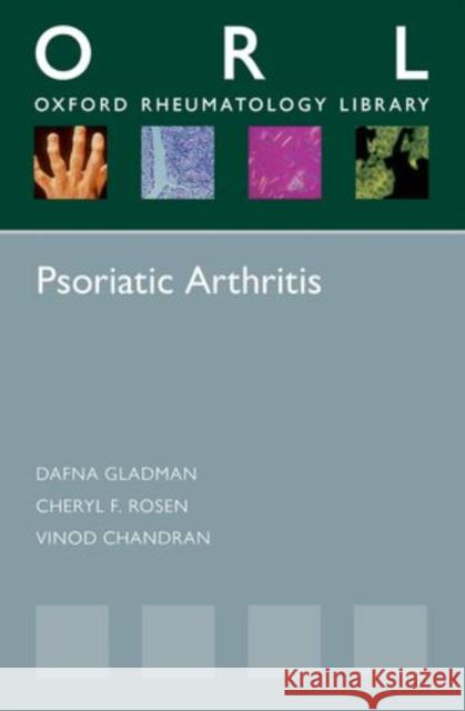 Psoriatic Arthritis Dafna Rose Gladman Cheryl F. Rosen Vinod Chandran 9780199692095