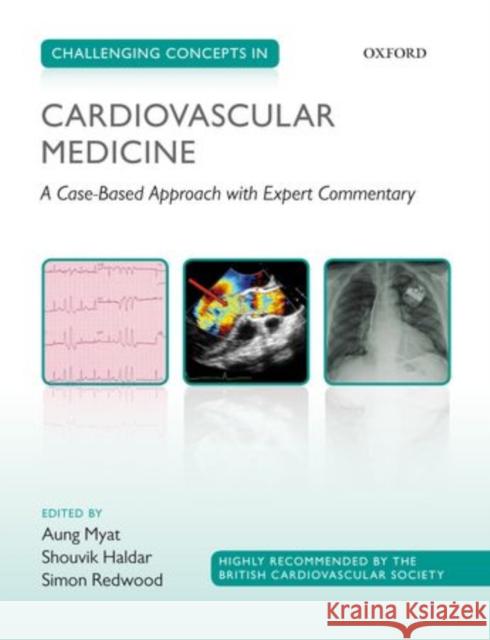 Challenging Concepts in Cardiovascular Medicine: Cases with Expert Commentary Myat, Aung 9780199695546