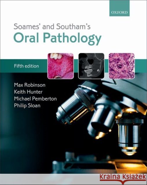 Soames' & Southam's Oral Pathology Max Robinson Keith Hunter Michael Pemberton 9780199697786
