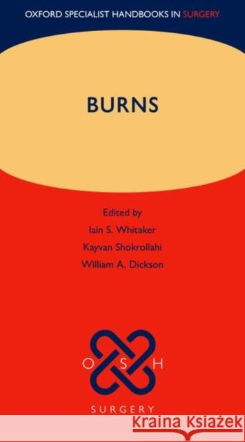 Burns Iain S. Whitaker Kayvan Shokrollahi William A. Dickson 9780199699537 Oxford University Press, USA