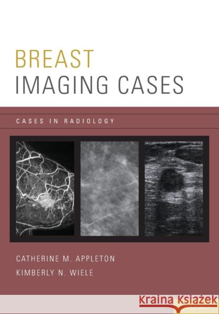 Breast Imaging Cases Catherine M. Appleton Kimberly N. Wiele 9780199731923 Oxford University Press, USA