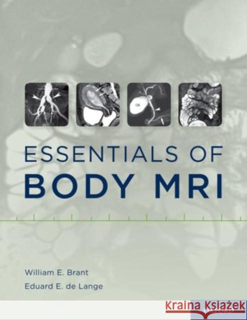 Essentials of Body MRI William E. Brant Eduard E. D 9780199738496 Oxford University Press, USA