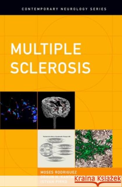 Multiple Sclerosis Moses Rodriguez Orhun H. Kantarci Istvan Pirko 9780199740468 Oxford University Press, USA