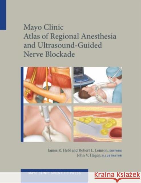Mayo Clinic Atlas of Regional Anesthesia and Ultrasound-Guided Nerve Blockade James, MD Hebl Robert, Do Lennon 9780199743032 Oxford University Press, USA