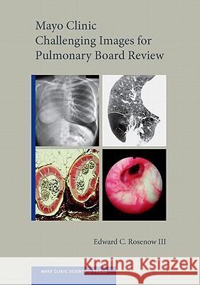 Mayo Clinic Challenging Images for Pulmonary Board Review Edward C., III Rosenow 9780199756926 Oxford University Press, USA