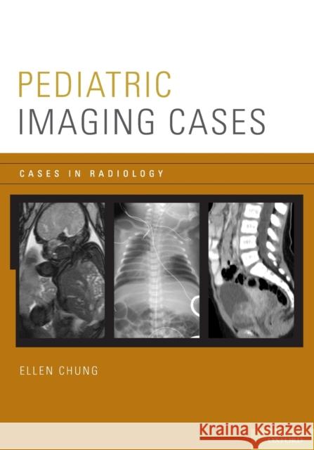 Pediatric Imaging Cases Ellen Chung 9780199758968 Oxford University Press, USA