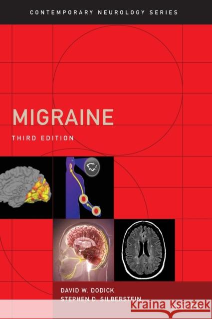 Migraine David Dodick Stephen D. Silberstein Robert A. Davidoff 9780199793617 Oxford University Press, USA