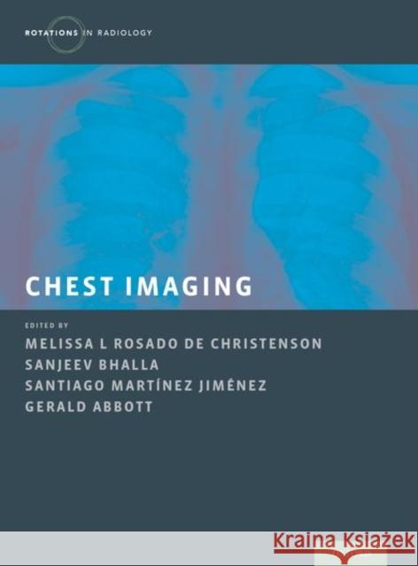 Chest Imaging Melissa L. Rosad Melissa Rosad Sanjeev Bhalla 9780199858064 Oxford University Press, USA