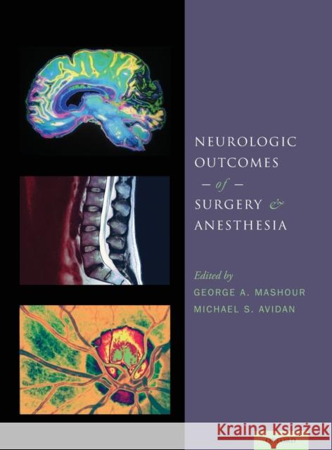 Neurologic Outcomes of Surgery and Anesthesia George A. Mashour 9780199895724 Oxford University Press