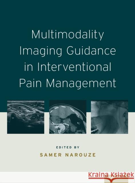 Multimodality Imaging Guidance in Interventional Pain Management Samer N., MD Narouze 9780199908004 Oxford University Press, USA