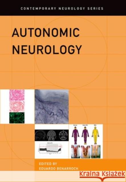 Autonomic Neurology Eduardo E. Benarroch Wolfgang Singer Michelle Mauermann 9780199920198 Oxford University Press, USA