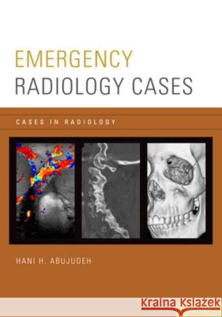 Emergency Radiology Cases Hani H. Abujudeh 9780199941179 Oxford University Press, USA