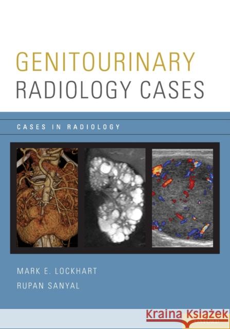 Genitourinary Radiology Cases Mark E. Lockhart Rupan Sanyal 9780199975747 Oxford University Press, USA