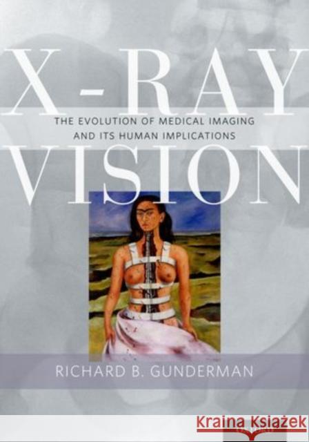 X-Ray Vision: The Evolution of Medical Imaging and Its Human Significance Gunderman, Richard B. 9780199976232 Oxford University Press