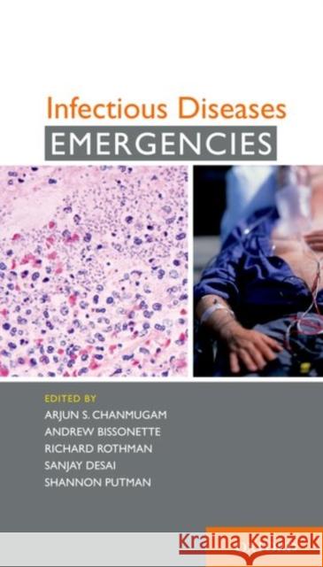 Infectious Diseases Emergencies Arjun S. Chanmugam Richard Rothman Sanjay Desai 9780199976805