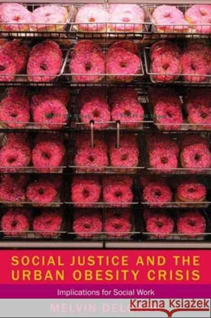 Social Justice and the Urban Obesity Crisis: Implications for Social Work Delgado, Melvin 9780231160094 0