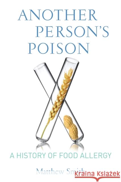Another Person's Poison: A History of Food Allergy Smith, Matthew 9780231164849 John Wiley & Sons
