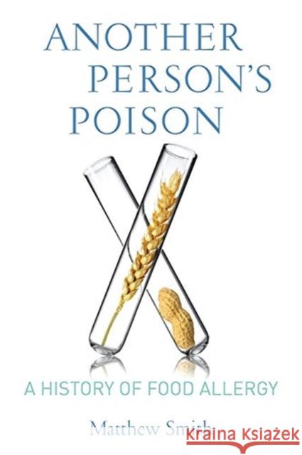 Another Person's Poison: A History of Food Allergy Smith, Matthew 9780231164856