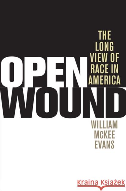 Open Wound: The Long View of Race in America William McKee Evans 9780252034275