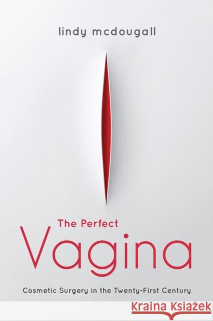 The Perfect Vagina: Cosmetic Surgery in the Twenty-First Century Lindy McDougall 9780253056139 Indiana University Press