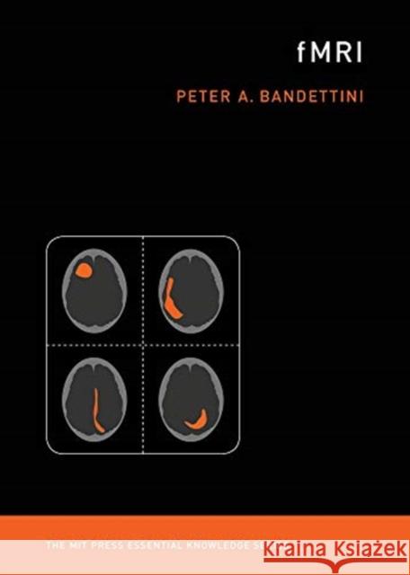 fMRI Peter A. (Chief, National Institute of Mental Health) Bandettini 9780262538039