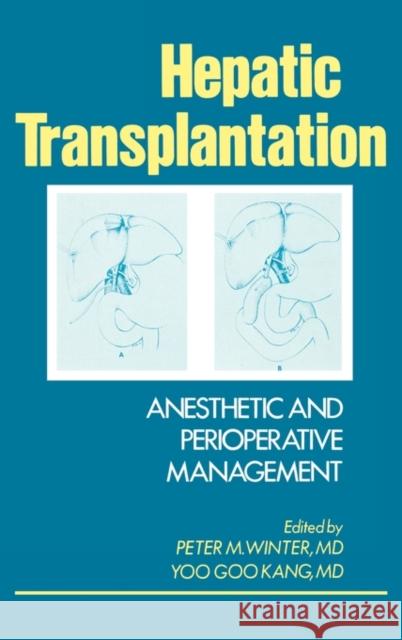 Hepatic Transplantation: Anesthetic and Perioperative Management Kang, Yoo Goo 9780275921293 Praeger Publishers