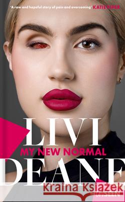 My New Normal: Learning to celebrate what's different about you Livi Deane 9780281088072