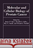 Molecular and Cellular Biology of Prostate Cancer D. S. Coffey James P. Karr R. G. Smith 9780306438844 Plenum Publishing Corporation