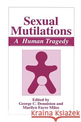Sexual Mutilations: A Human Tragedy Denniston, George C. 9780306455896