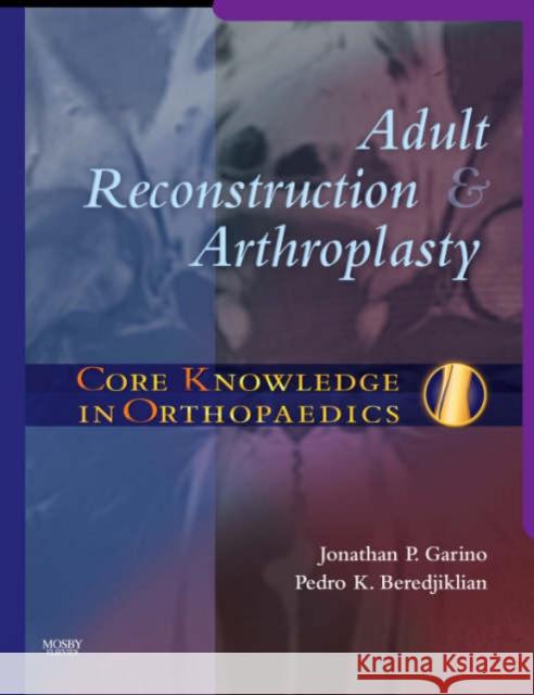 Core Knowledge in Orthopaedics: Adult Reconstruction and Arthroplasty Jonathan P. Garino Pedro K. Beredjiklian 9780323033701 Mosby