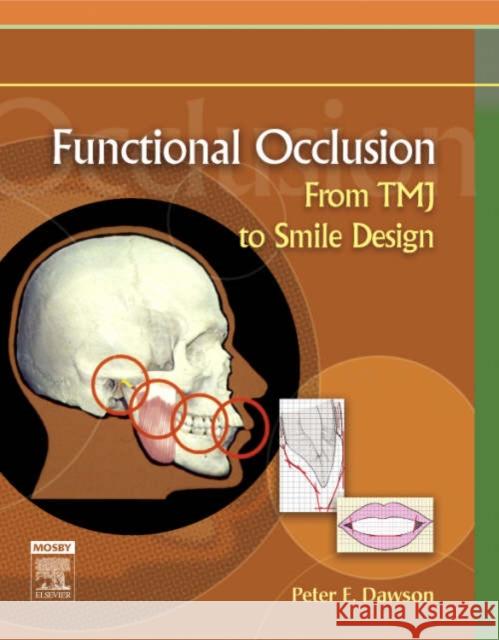 Functional Occlusion: From Tmj to Smile Design Dawson, Peter E. 9780323033718
