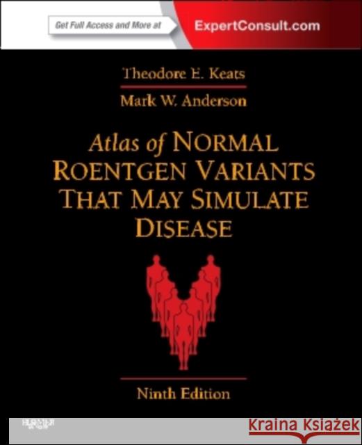 Atlas of Normal Roentgen Variants That May Simulate Disease: Expert Consult - Enhanced Online Features and Print Mark W. (Harrison Distinguished Teaching Professor of Radiology; Chief, Musculoskeletal Imaging, Professor of Orthopaedi 9780323073554 Elsevier - Health Sciences Division