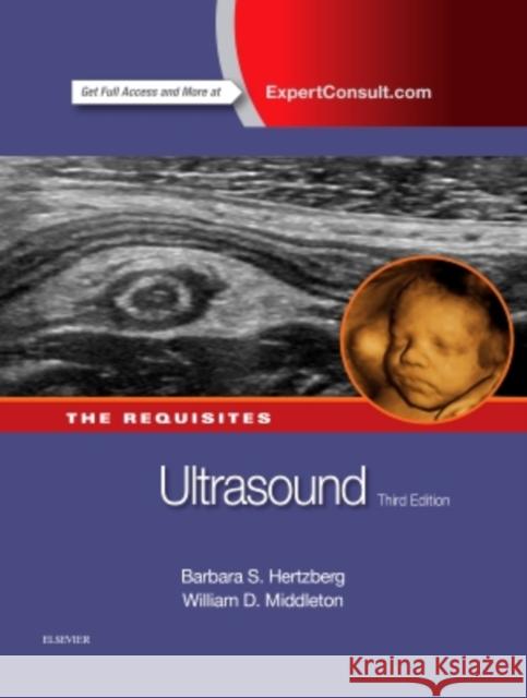 Ultrasound: The Requisites William Dana, MD, FACR (Professor of Radiology, Director of Ultrasonography, Mallinckrodt Institute of Radiology, Washin 9780323086189 Elsevier Saunders