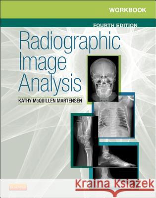 Workbook for Radiographic Image Analysis Kathy McQuillen Martensen 9780323280716 Elsevier Saunders