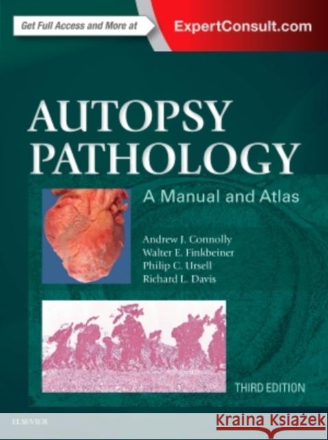 Autopsy Pathology: A Manual and Atlas Andrew Connolly 9780323287807