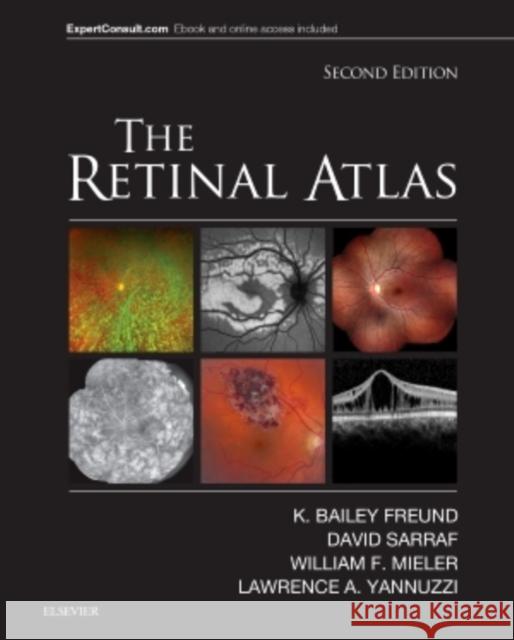 The Retinal Atlas Freund, K. Bailey 9780323287920 Elsevier