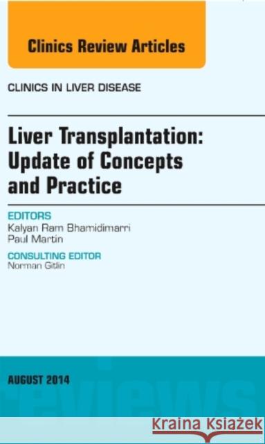 Liver Transplantation: Update of Concepts and Practice, an Issue of Clinics in Liver Disease: Volume 18-3 Bhamidimarri, Kalyan Ram 9780323320160 Elsevier