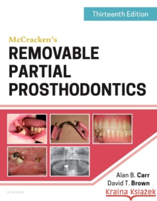 McCracken's Removable Partial Prosthodontics Alan B. Carr David T. Brown 9780323339902 Mosby