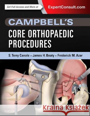 Campbell's Core Orthopaedic Procedures S. Terry Canale James H. Beaty Frederick M. Azar 9780323357630 Saunders