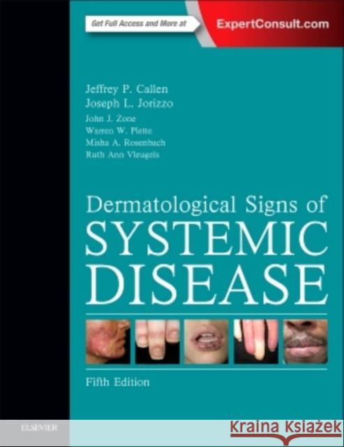 Dermatological Signs of Systemic Disease Jeffrey Callen 9780323358293 Elsevier Health Sciences