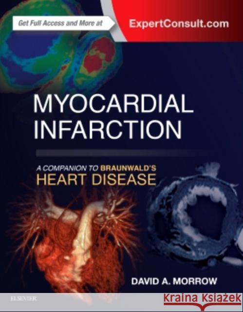 Myocardial Infarction: A Companion to Braunwald's Heart Disease David A. Morrow 9780323359436