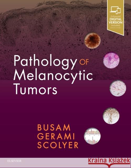 Pathology of Melanocytic Tumors Busam, Klaus J. 9780323374576 Elsevier