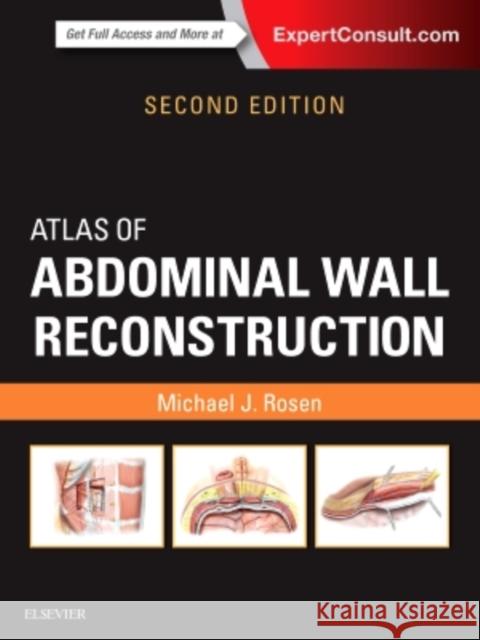 Atlas of Abdominal Wall Reconstruction Michael J. Rosen   9780323374590 Elsevier - Health Sciences Division