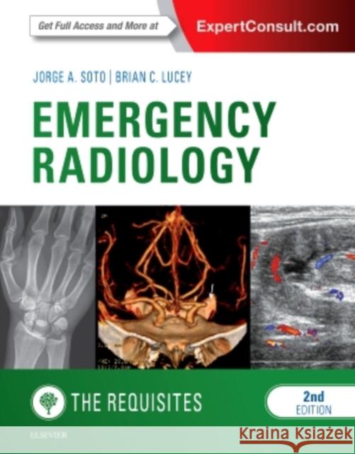 Emergency Radiology: The Requisites Jorge Soto 9780323376402 Elsevier Health Sciences