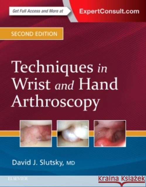 Techniques in Wrist and Hand Arthroscopy David J. Slutsky   9780323392662 Elsevier - Health Sciences Division