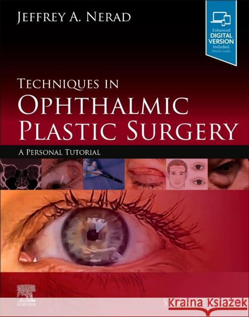 Techniques in Ophthalmic Plastic Surgery: A Personal Tutorial Jeffrey A. Nerad   9780323393164