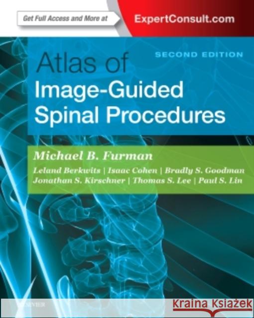 Atlas of Image-Guided Spinal Procedures Michael Bruce Furman 9780323401531 Elsevier