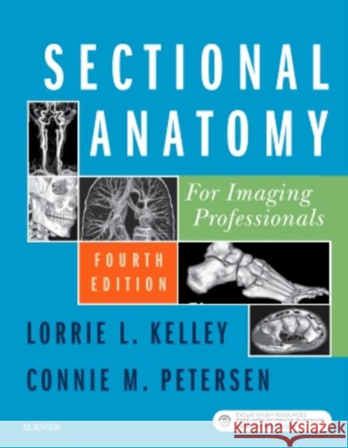 Sectional Anatomy for Imaging Professionals Lorrie L. Kelley Connie Petersen  9780323414876 Mosby